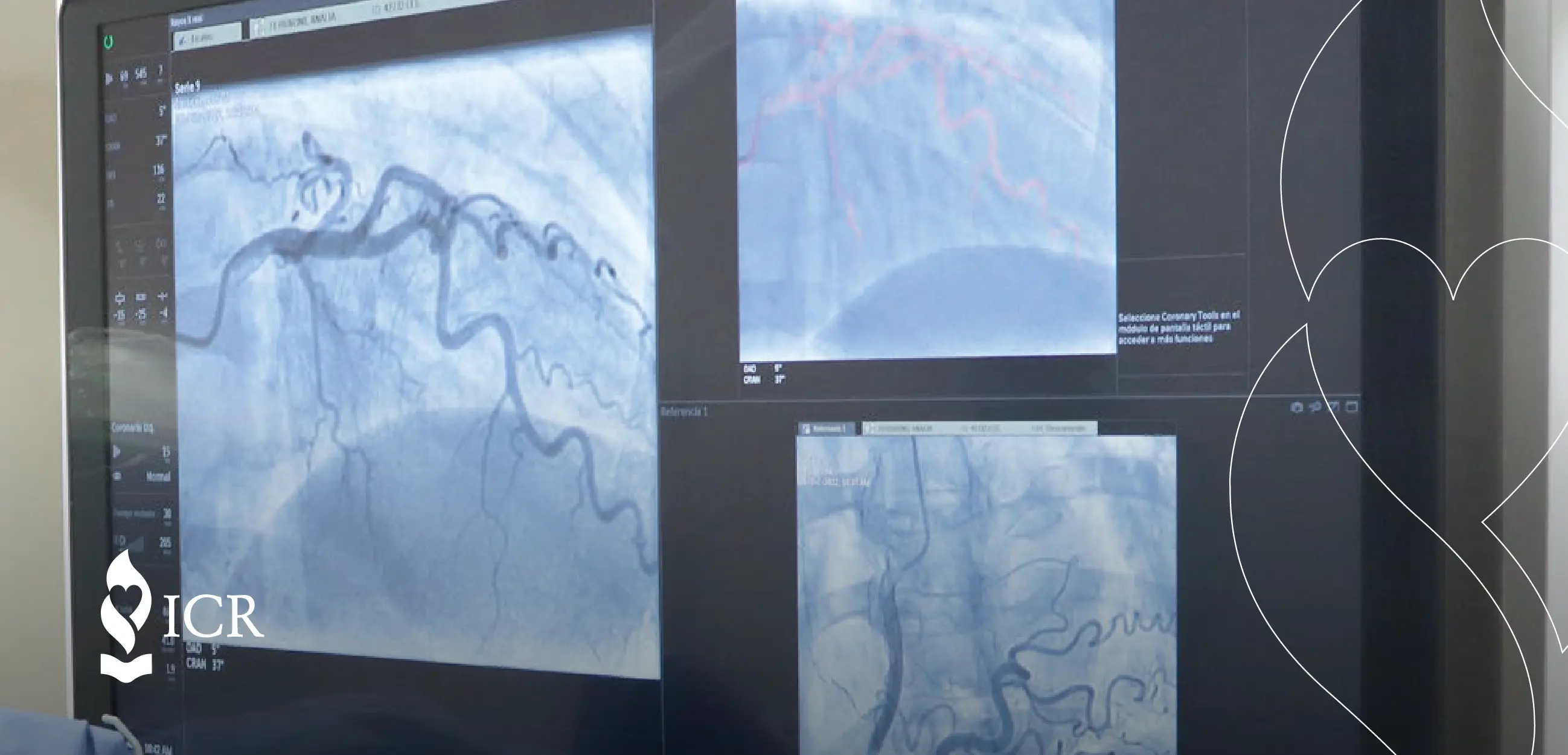 Compromiso y actualización constante al servicio de la Salud Cardiovascular