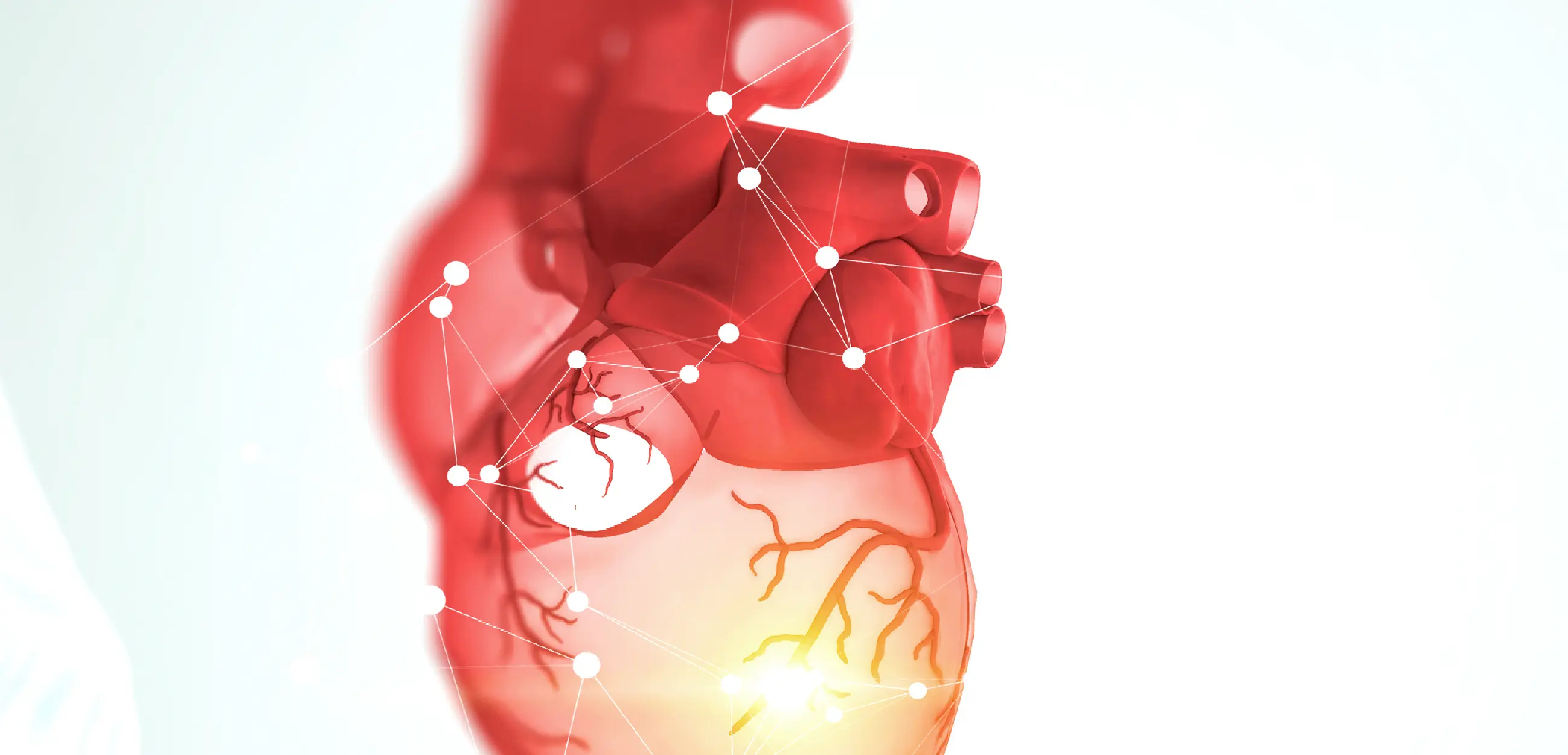 RMI de 1,5 Tesla Philips para imágenes cardiovasculares