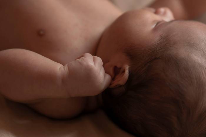 El Sanatorio de Niños realizó un trasplante hepático en un bebé prematuro de menos de 2 kilos